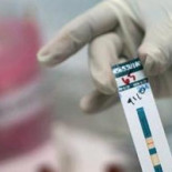 Diseñan la molécula que bloquea la multiplicación del virus del sida