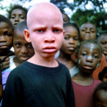 El tabú de los negros blancos