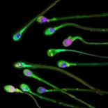 El semen de los españoles, el peor de Europa pero el más efectivo