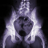 Una 'Wikipedia' de imágenes médicas