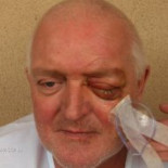 Pierde la visión de un ojo al intentar defender a una mujer de una agresión