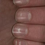 Las uñas y sus famosas manchitas blancas