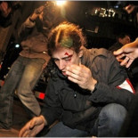 Fotografo agredido por los mossos: "Grité a los policías que éramos todos de prensa, y aun así vinieron a por mí"