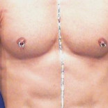 Riesgos de llevar un piercing en los genitales