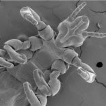 Científicos secuencian el genoma del piojo