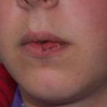 Acusan a un policía municipal de partirle el labio de un puñetazo a un menor