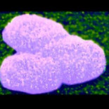 Una niña con cromosomas Y arroja luz sobre la masculinidad