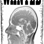 Soy un cerebro fugado