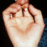 Las adolescentes españolas fuman más que los chicos