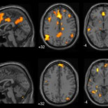 "Soñar despierto" activa la función de resolución de problemas del cerebro