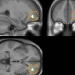 La meditación aumenta la materia gris del cerebro (ING)