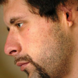 Le cosen una oreja dentro del estómago para regenerar los tejidos. (ING)