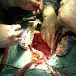 Dos de cada tres denuncias por agresiones sexuales son falsas