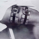 Piojos, el arma de Weigl contra los nazis