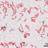 Una bacteria desvela uno de los secretos mejor guardados de la evolución