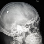 Un francotirador en Vallecas