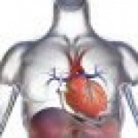 Cirujanos alemanes implantan el primer mini corazón artificial