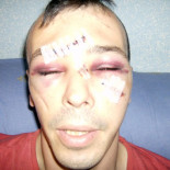 Violenta agresión nazi a un grupo de jóvenes en Alcorcón