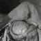 Así se operaba un tumor en los años '30