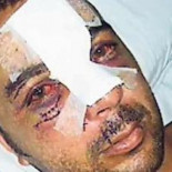 Un joven gallego sufre una paliza por defender a una mujer de la agresión de su marido