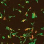 ¿Por qué los chimpancés no pueden hablar?