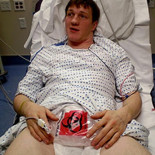 El hombre que se rompió el pene