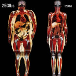 Radiografía de la obesidad femenina