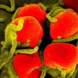 Nueva cepa de gonorrea resistente a a todos los antibióticos disponibles actualmente