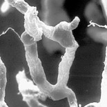 Superando la barrera hematoencefálica