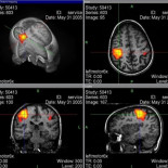 Los hallazgos sobre el cerebro podrían suponer "la cuarta humillación humana",