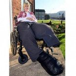 Le amputaron una pierna de 30 kg y le está creciendo de nuevo