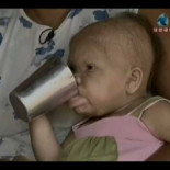 Mujer de 30 años que parece un bebé de 9 meses