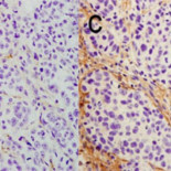 Científicos españoles descubren cómo reducir los tumores cancerígenos hasta un 80%