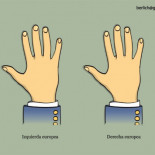 La Izquierda europea