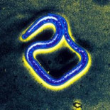 El misterioso síndrome de "asentir con la cabeza" se difunde a través de Uganda (ING)