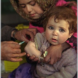 El sarampión puede matar, su vacuna no