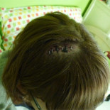 "Tengo seis grapas y una brecha de siete centímetros por defender mis derechos"