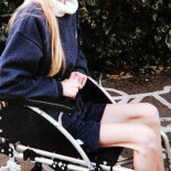 Impresionante recuperación de una joven anoréxica que se encontraba al borde de la muerte