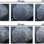 Las garrapatas sobreviven al vacío