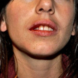 Habla Marta, la chica a la que un policía dio un puñetazo en la boca