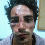 Agredido el hijo de un concejal de Podemos después de denunciar un caso de corrupción en Fuerteventura