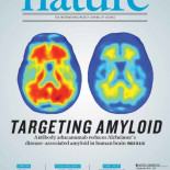 Alzhéimer, ¿el fin de la expedición?