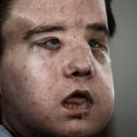 Un francés consigue su tercera cara [ENG]