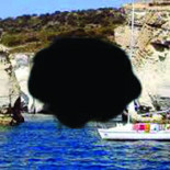 Degeneracion Macular