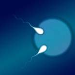 Identifican por primera vez un embarazo de gemelos semi-idénticos (ING)