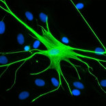 Descubren el circuito cerebral de los comportamientos repetitivos