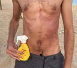 Quemaduras en la piel y prohibido volver a tomar el sol: esta crema solar de Mercadona está siendo investigada