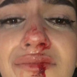 Una influencer sufre una paliza en Barcelona por ser trans: "No quiero morir mañana"