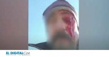 Pierde un ojo en Toledo al ser agredido por dos cazadores que disparaban junto a las viviendas