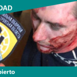 Neonazis del Batallón Azov torturan y detienen a pacifistas y activistas de izquierda
